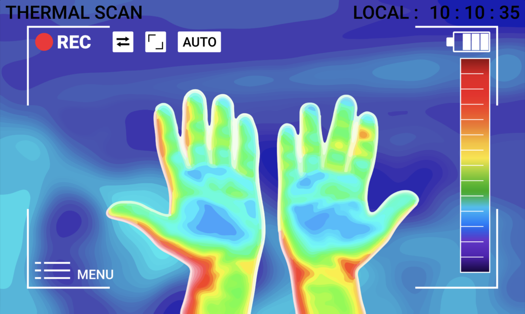 Wärmebild von Handinnenflächen